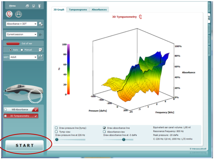 Titan Wideband Tympanometry Research License Interacoustics
